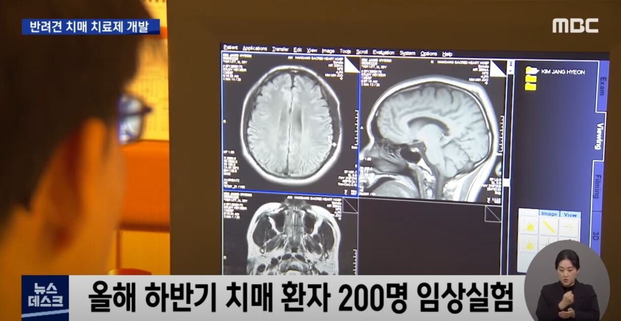 개 치매 치료제 개발에 성공한 한국 연구진