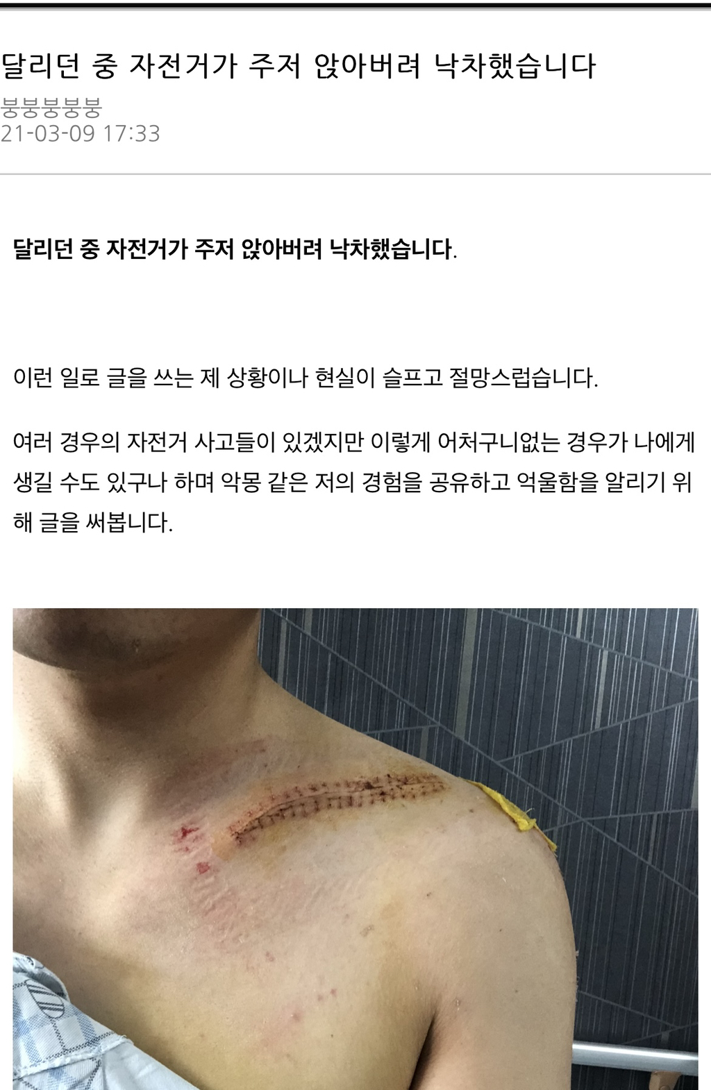 13.5 million won bike smashed while riding