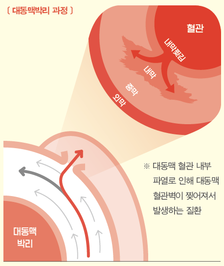 베르세르크 작가 분 사망원인