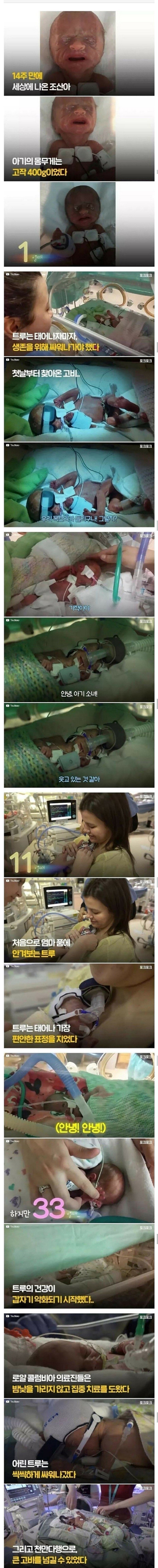 The miracle of a 26-week-old premature baby.jpg