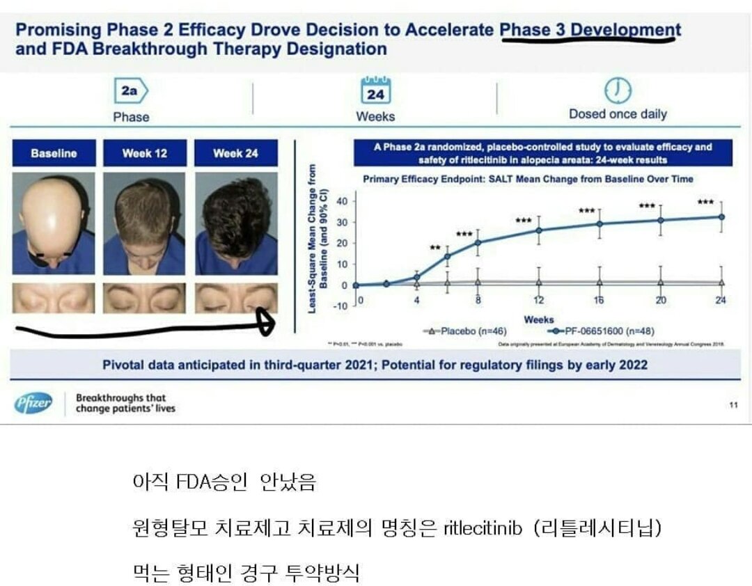 Pfizer Develops New Drugs