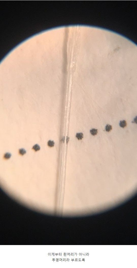 White hair seen through a microscope.jpg