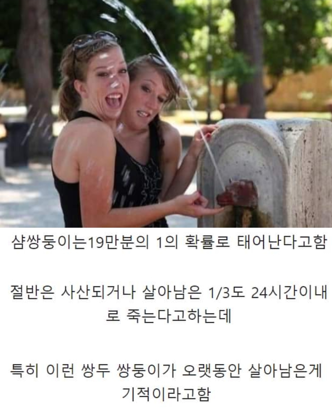 현시대 유일한 성인 샴쌍둥이.jpg