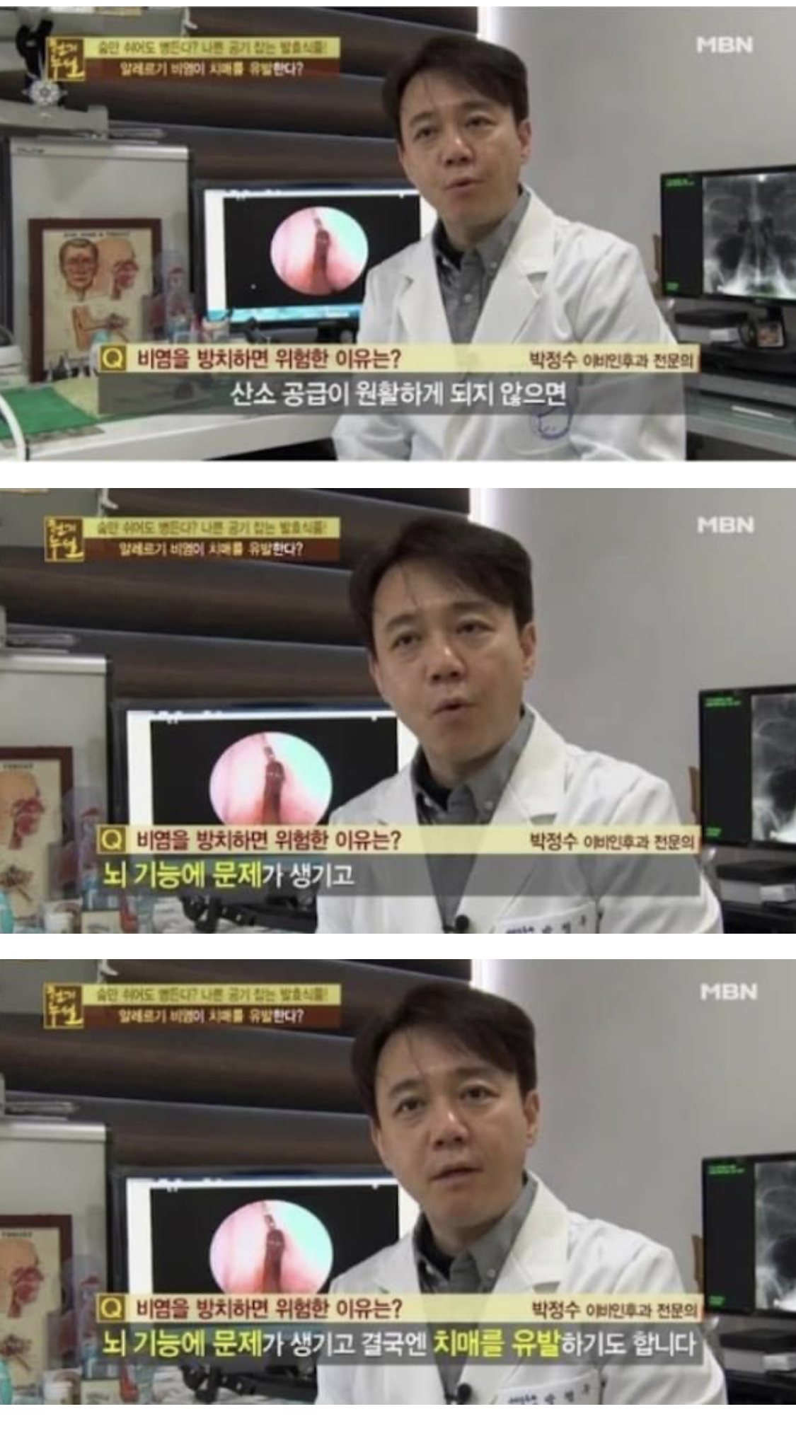 비염 방치하면 절대 안되는 이유