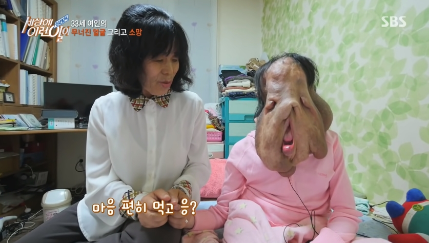 "Capture the Moment" The 33-year-old woman's broken face, Shim Hyunhee's recent status - Watch out for anger