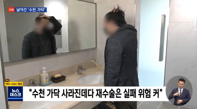 Hair loss patient who underwent a hair transplant surgery 멀 A hospital that lost 4,000 normal hair and said it's over with a refund.