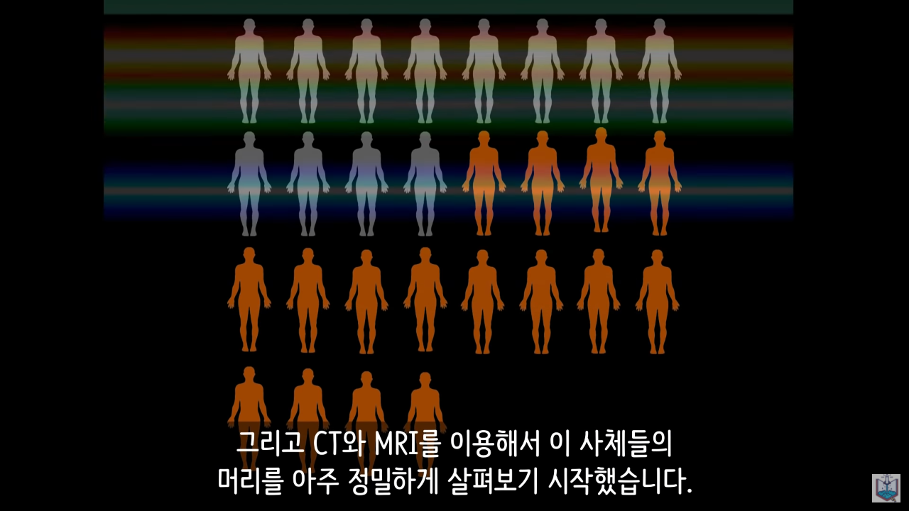 인간의 새로운 턱 근육이 발견됨.JPG