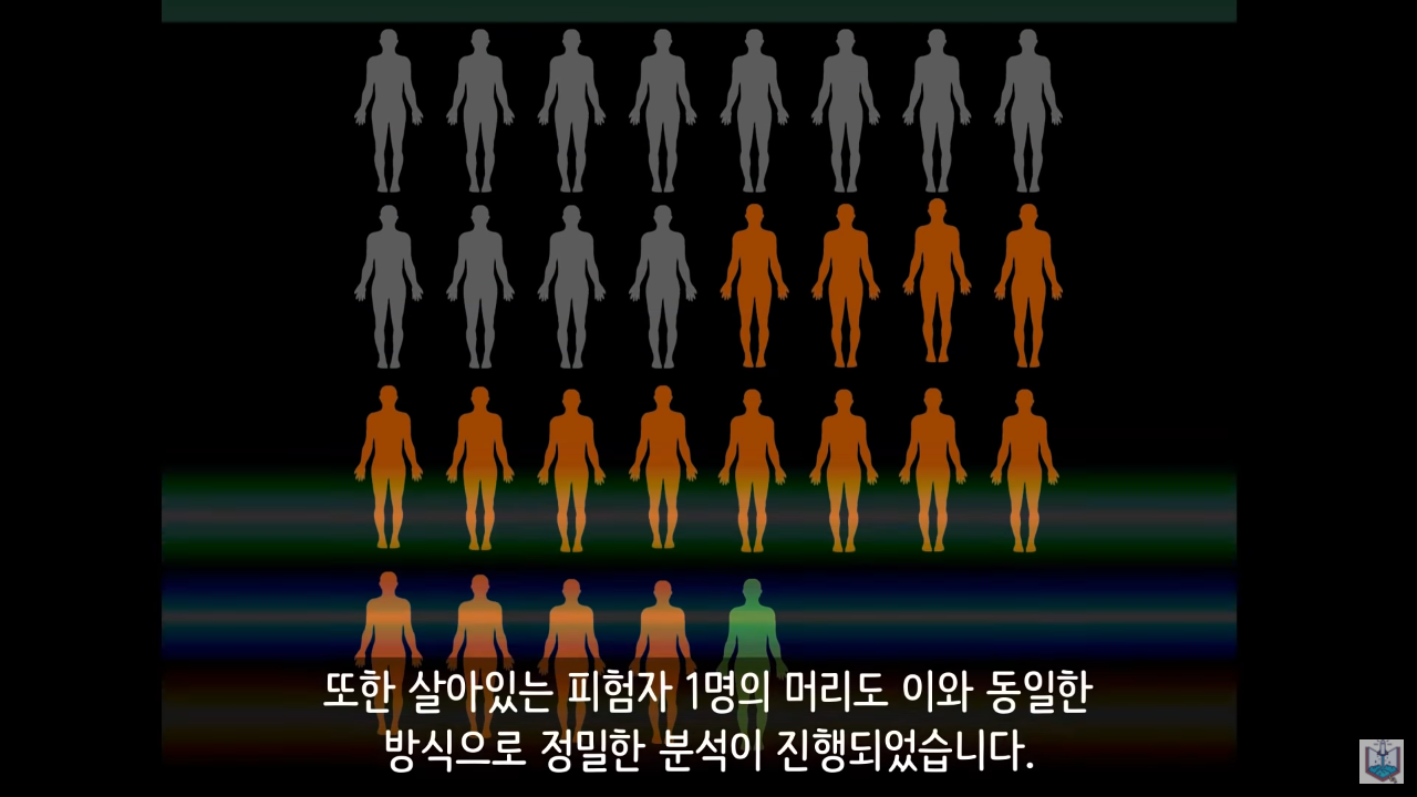 인간의 새로운 턱 근육이 발견됨.JPG