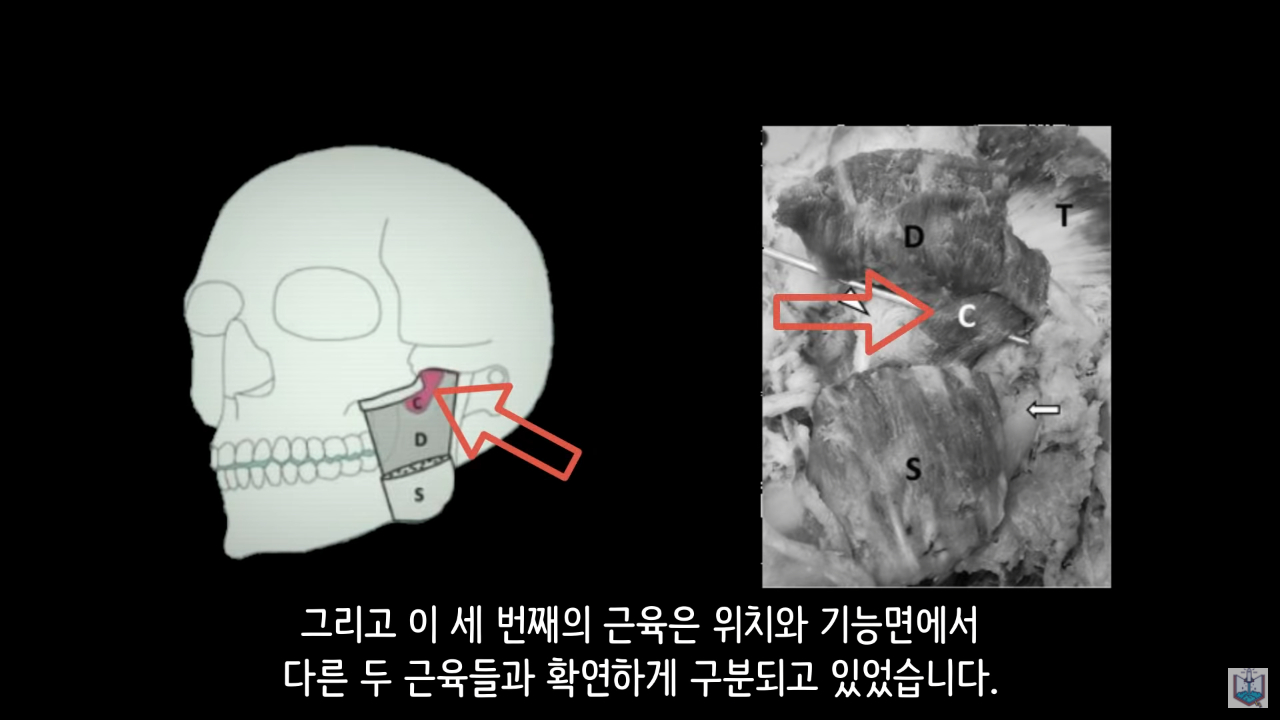 인간의 새로운 턱 근육이 발견됨.JPG