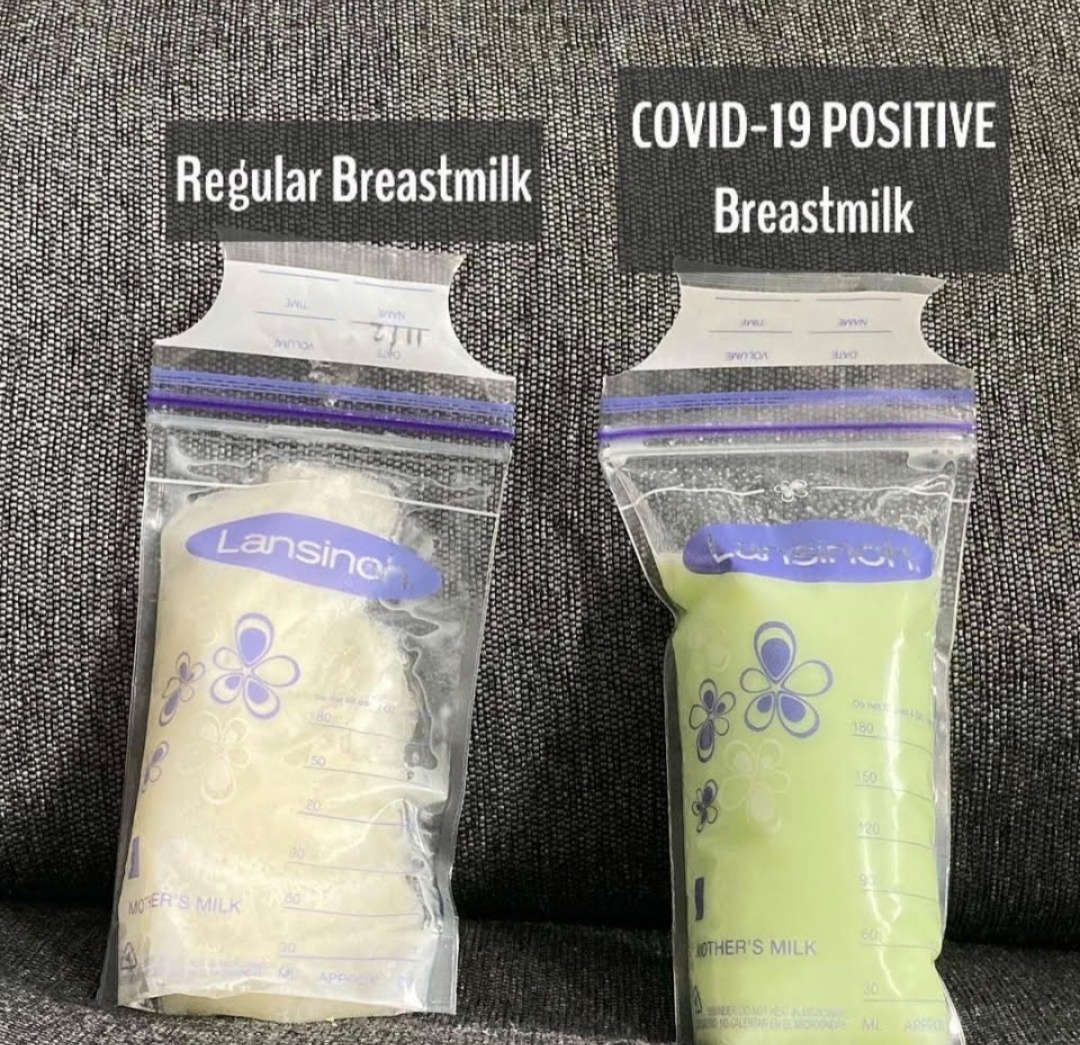 After COVID-19, the color of breast milk changed to light green.