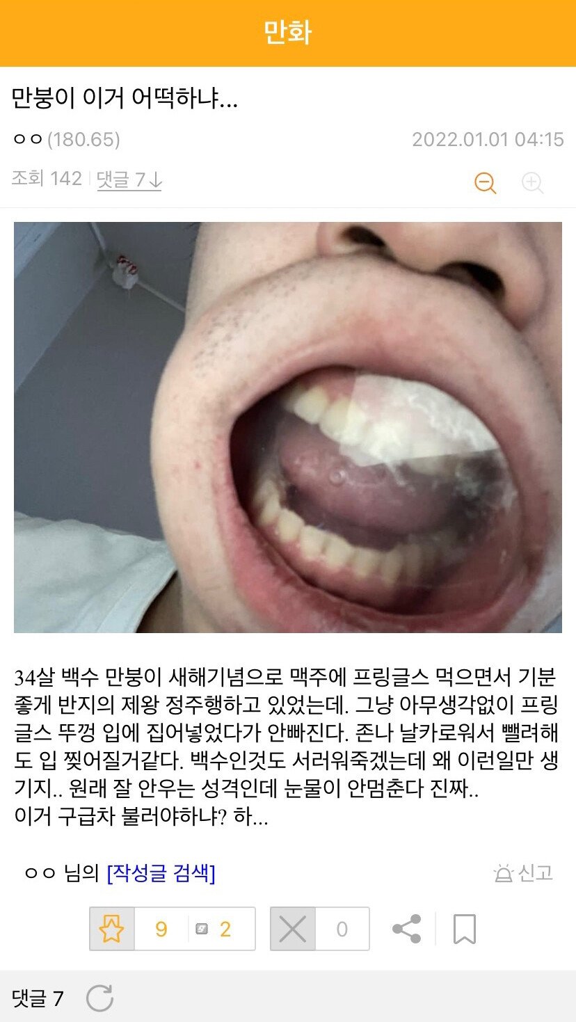 만갤 레전드