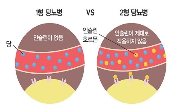 にきびと砂糖の関係性