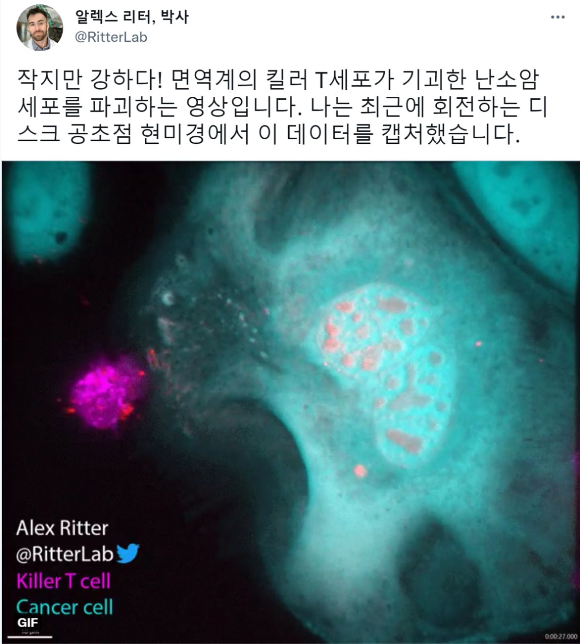 면역 T세포가 난소암 세포를 파괴하는 장면 최초로 공개