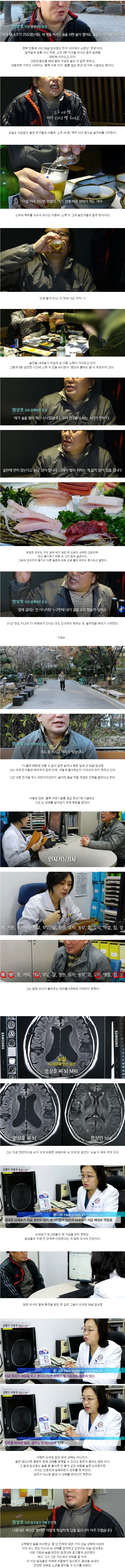 술 많이 마시는 50대의 뇌 상태