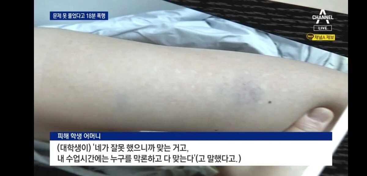 昨日、ソウル某大学工学部生が課外学生に暴行したCCTV公開