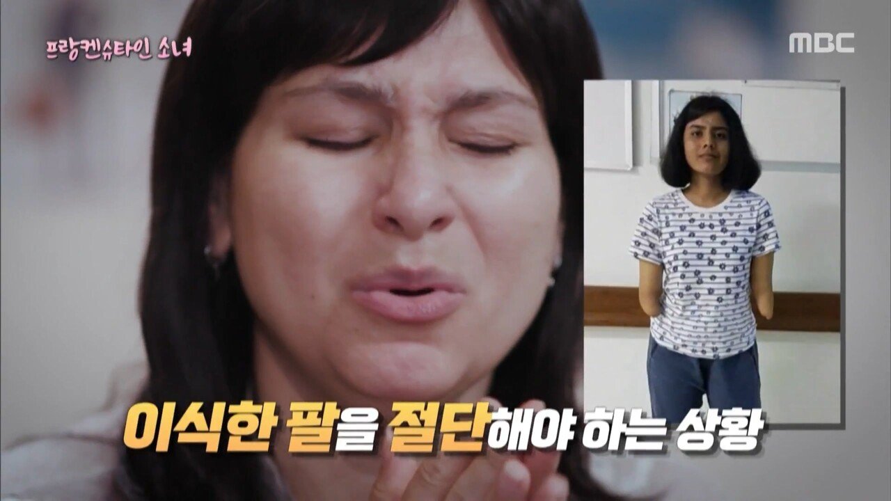 남자의 팔을 이식한 프랑켄슈타인 소녀