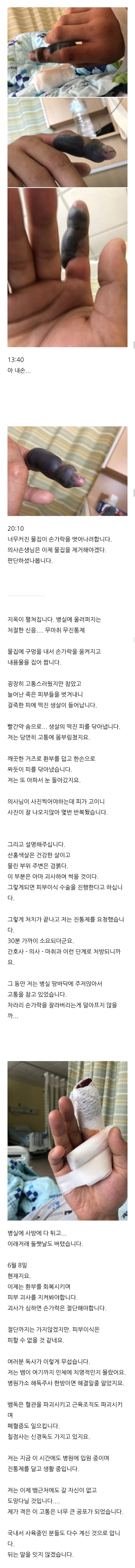 혐) 뱀 절대 쉽게 보지 마세요