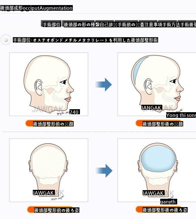 SOUND男子が意外にたくさんする成形jpg