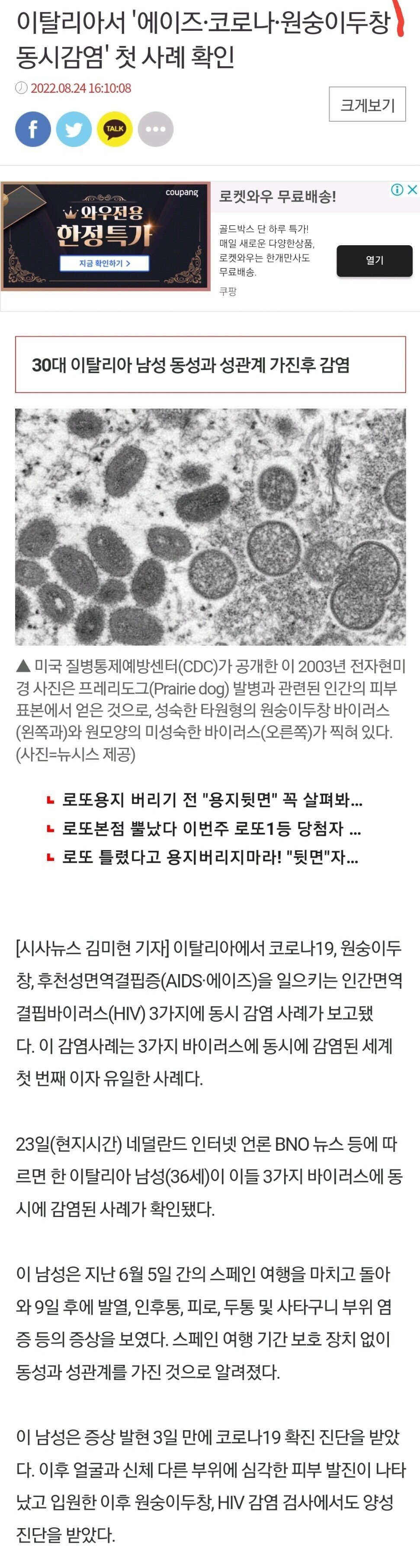 에이즈코로나두창 동시감염 터졌다..jpg