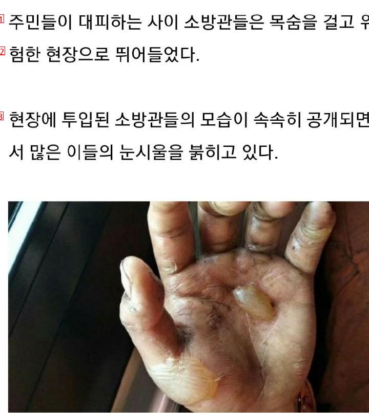 불끄고 나온 소방관의 손...