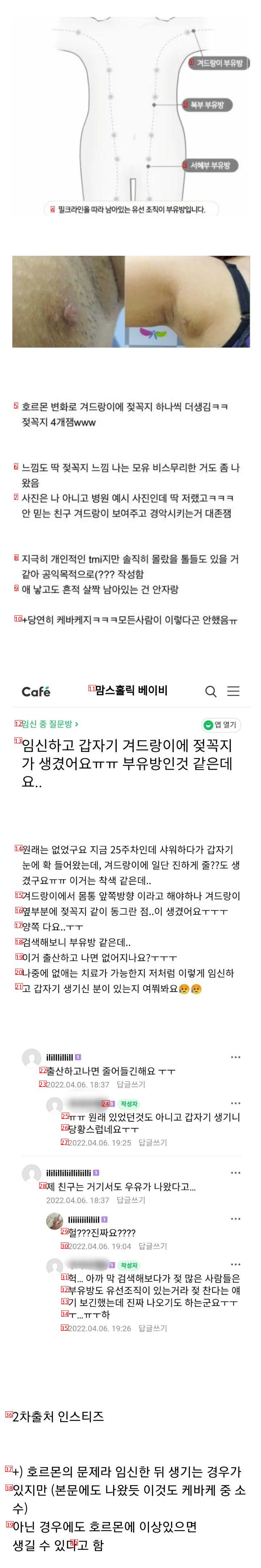 여자들 임신하고 나서 간혹 생기는 신체변화