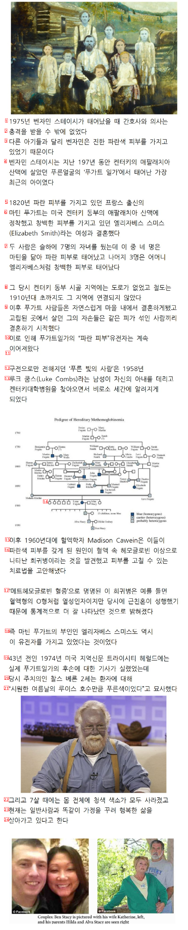 근 200년간 한 가문의 피부가 파란색이었던 이유