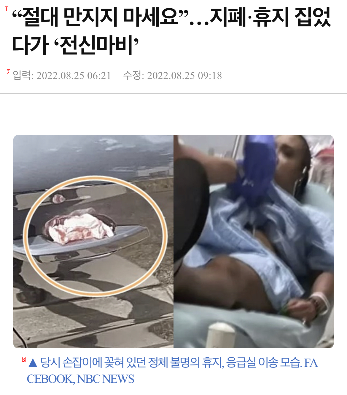 """"지폐에 마약성분?"""" 돈 주었다가 전신마비. """"죽다 살아났다""""