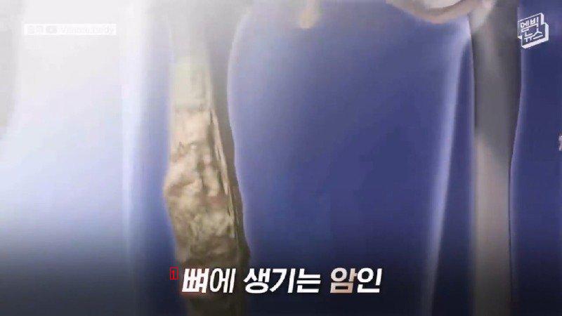 의사가 발 거꾸로 붙여줬는데 고마워서 울었다는 남성