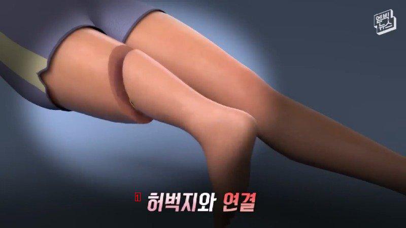 의사가 발 거꾸로 붙여줬는데 고마워서 울었다는 남성