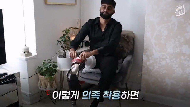 의사가 발 거꾸로 붙여줬는데 고마워서 울었다는 남성