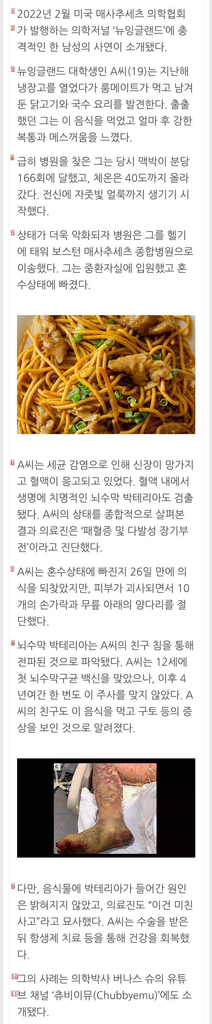 친구가 남긴 음식 먹고 ''손가락 10개두 다리'' 절단한 남성