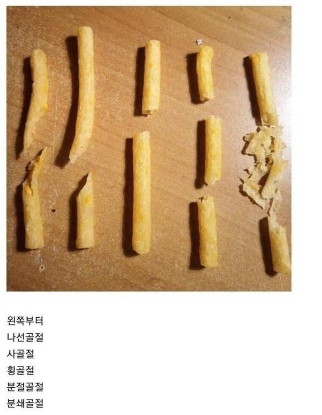 과자로 알아보는 사람 뼈 골절