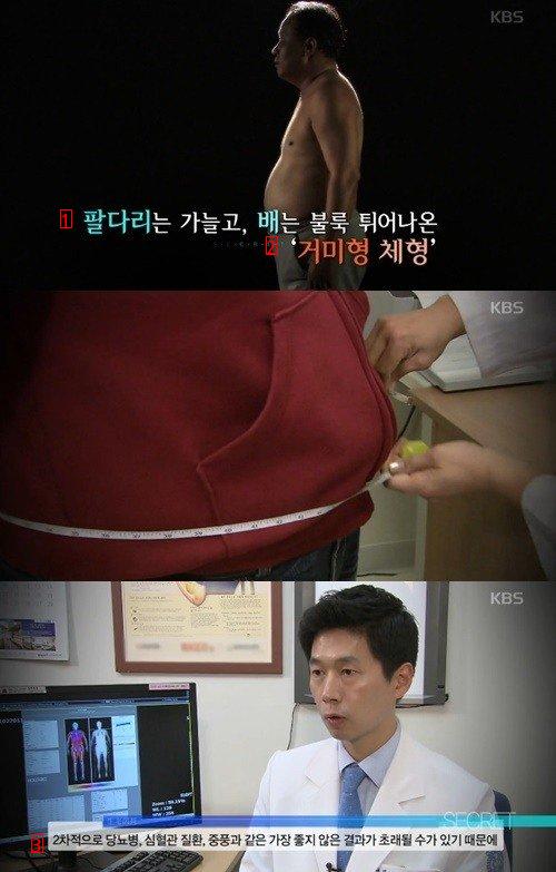 가장 위험하다는 체형