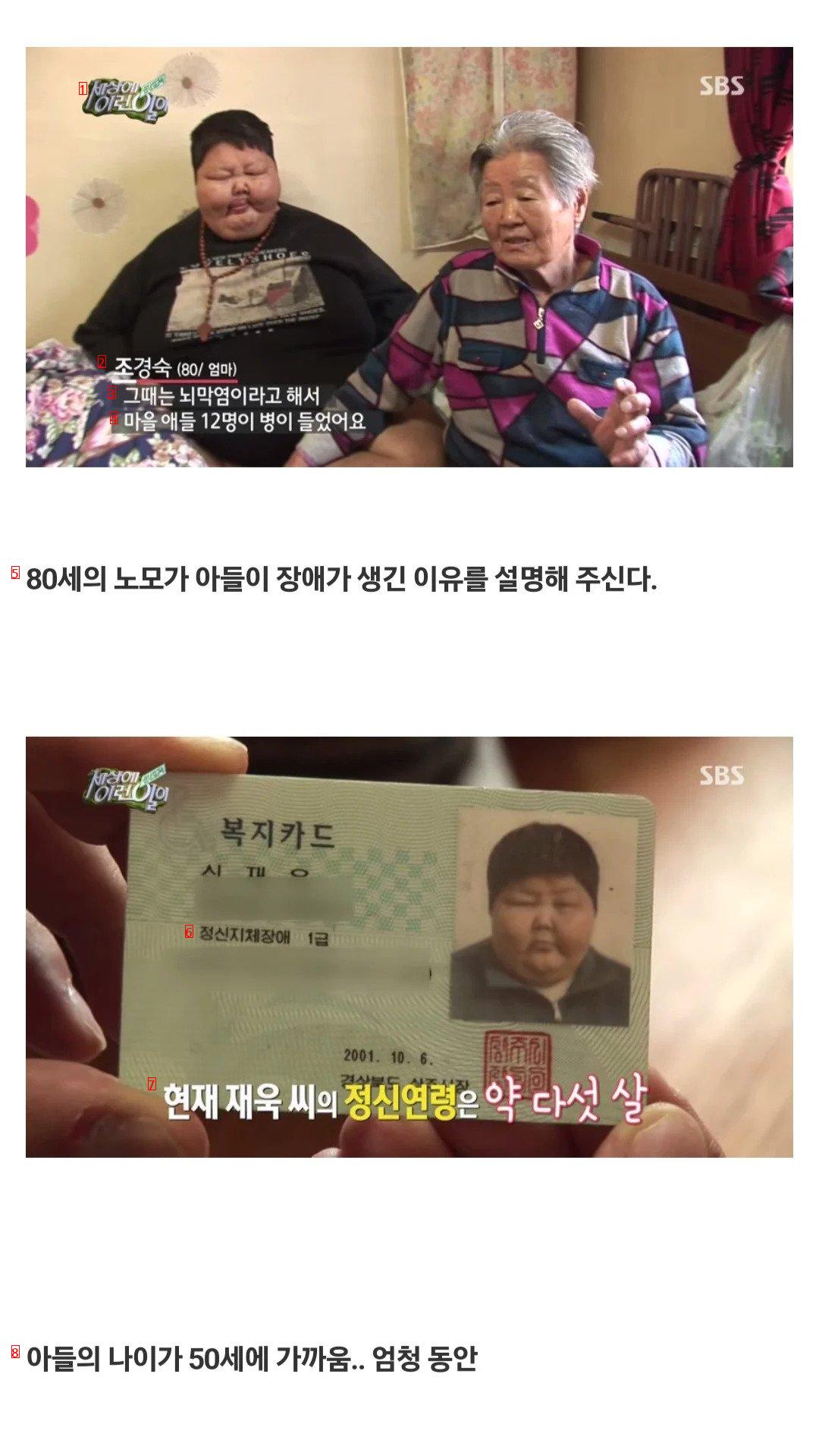 ''세상에 이런일이'' 초고도 비만 아들