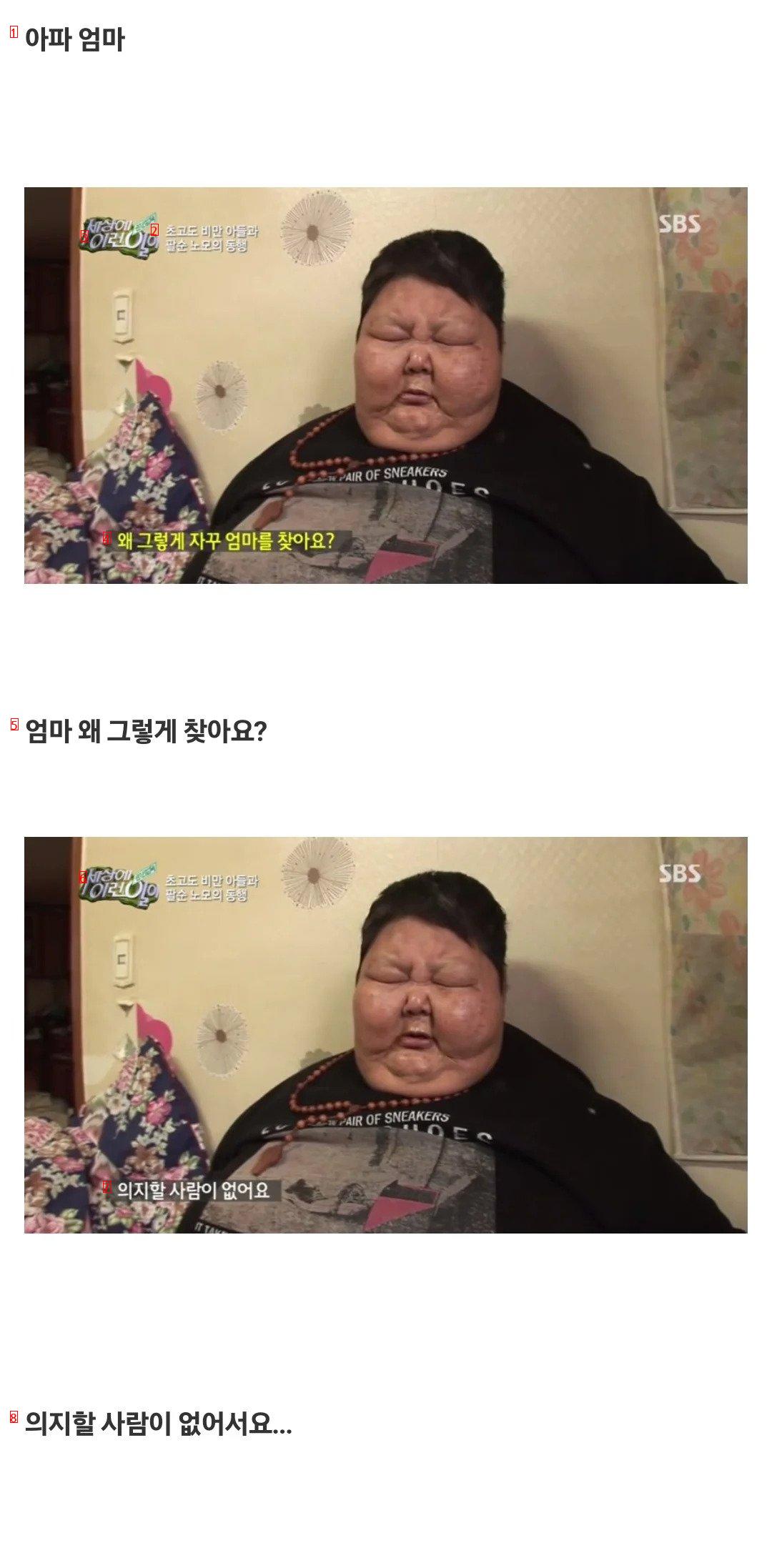 ''세상에 이런일이'' 초고도 비만 아들