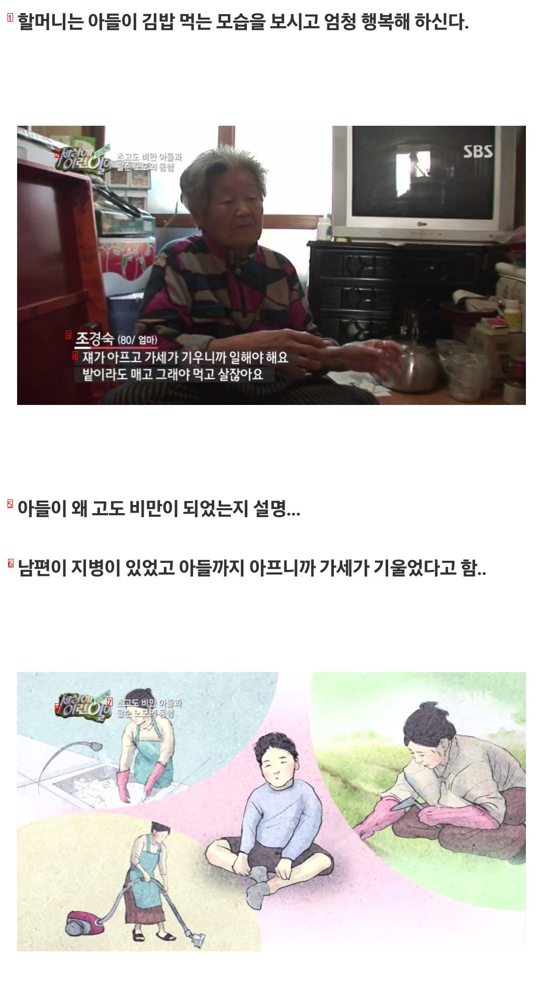 ''세상에 이런일이'' 초고도 비만 아들