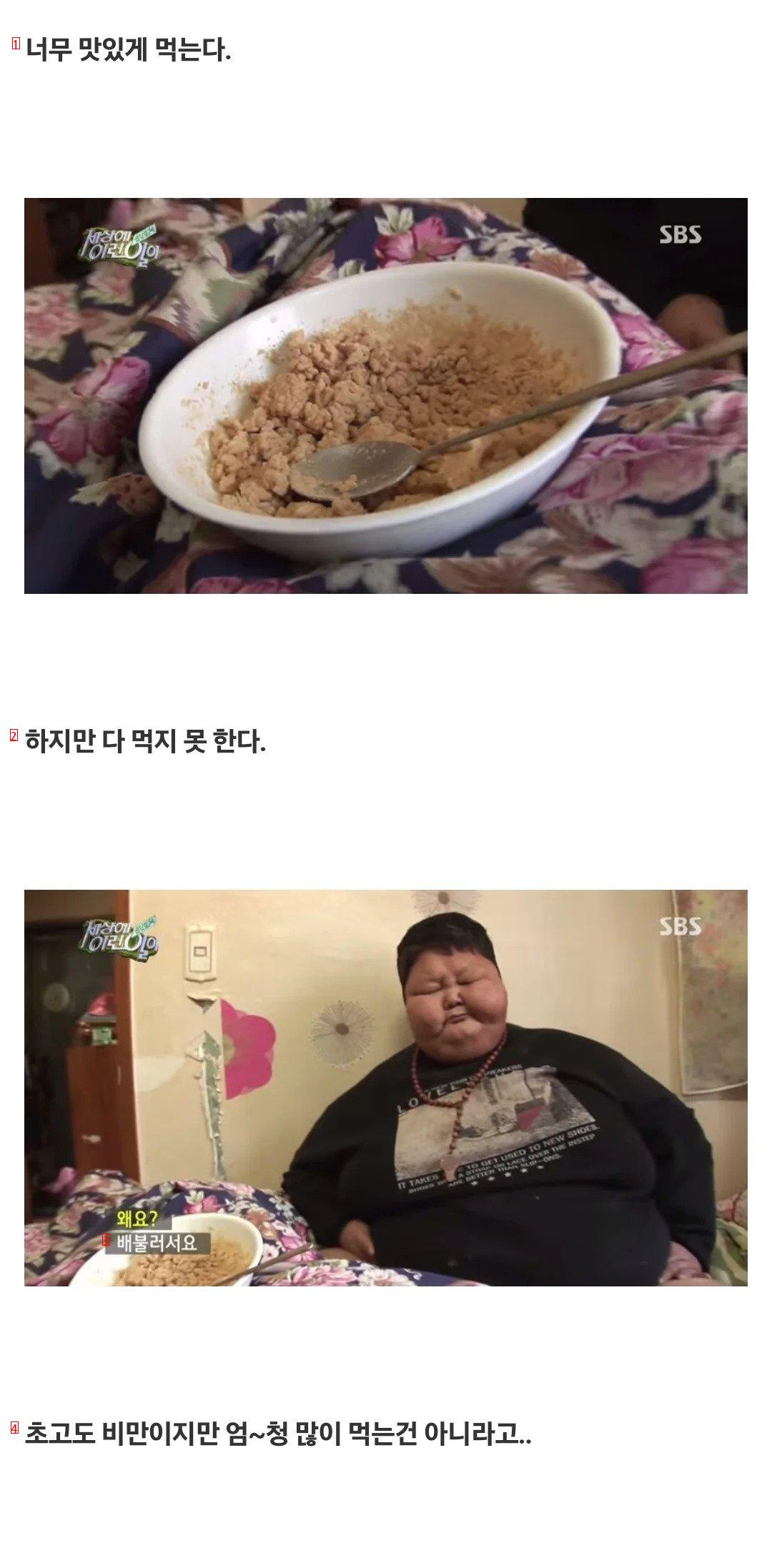 ''세상에 이런일이'' 초고도 비만 아들