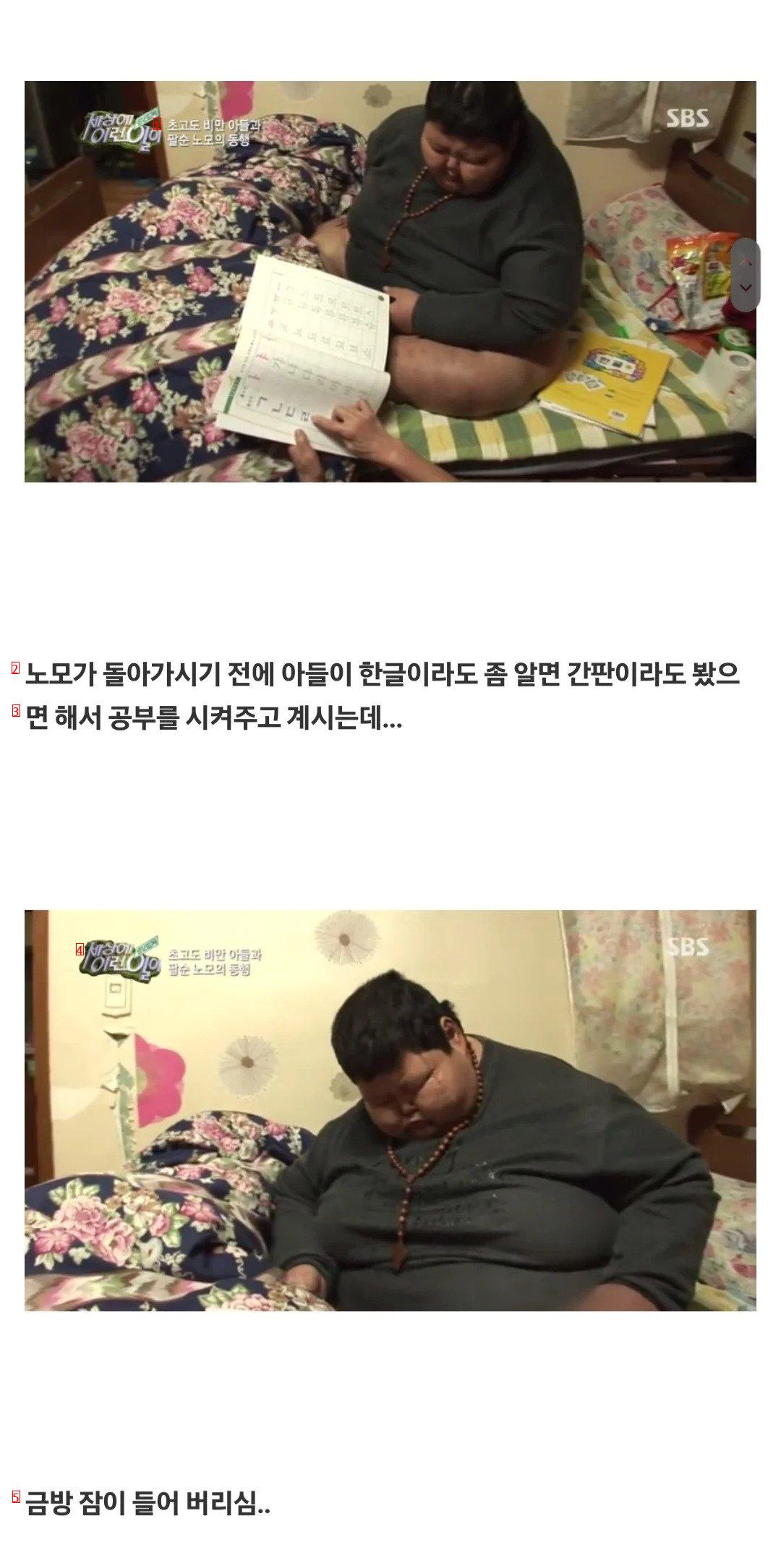 ''세상에 이런일이'' 초고도 비만 아들