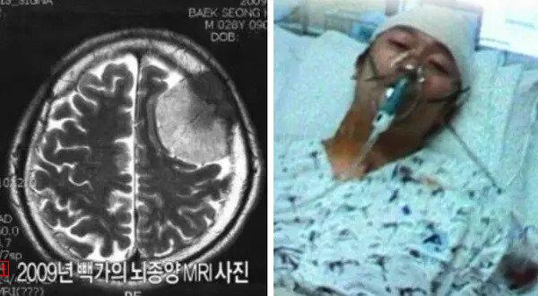 코요태 빽가 뇌종양 당시, MRI 사진