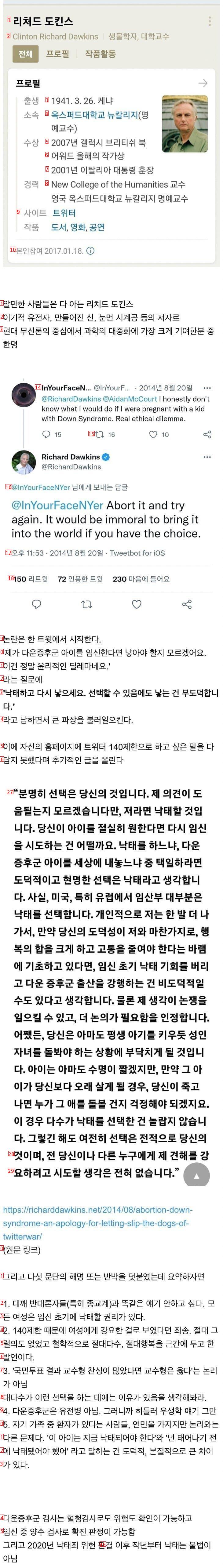 다운증후군 아이는 낙태하라는 교수.JPG