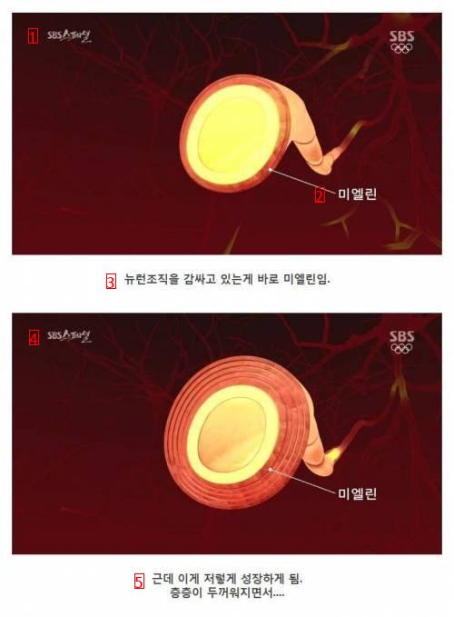 나이 먹으면 머리가 안 돌아간다는 말은 핑계.jpg