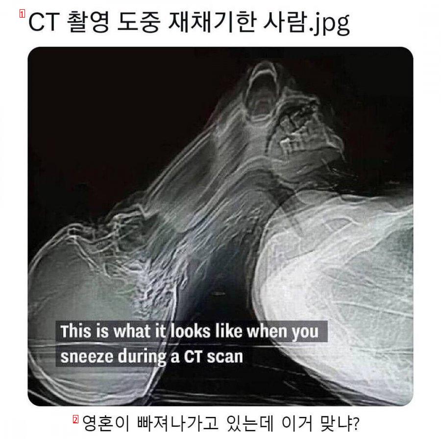 CT 촬영 도중 재채기한 사람.jpg