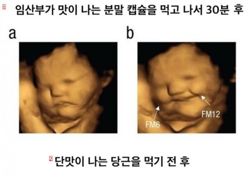 임신했을 때 아기가 먹고싶다는 말이 맞나봄