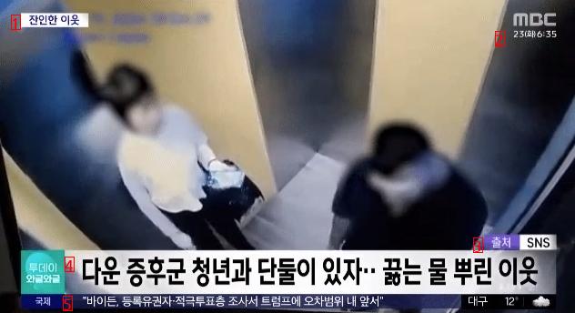 엘리베이터에서 만난 다운증후군 남성에게 뜨거운물 부은 여자