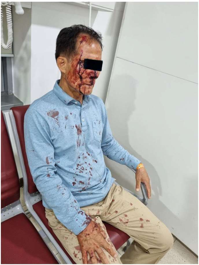 혐) 포항에서 승객 폭행에 코뼈 부러진 택시기사