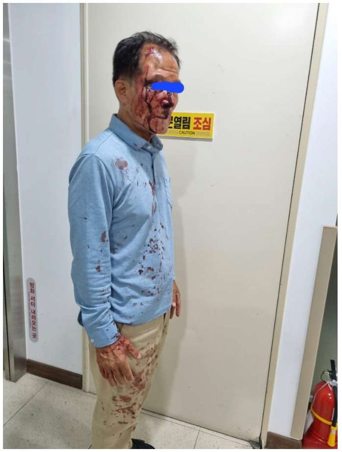 혐) 포항에서 승객 폭행에 코뼈 부러진 택시기사