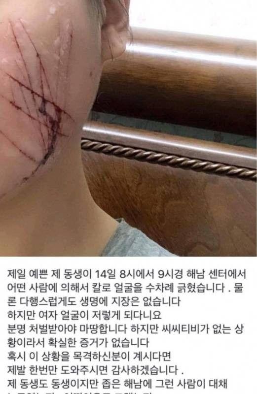 여자라서 당했다구!!
