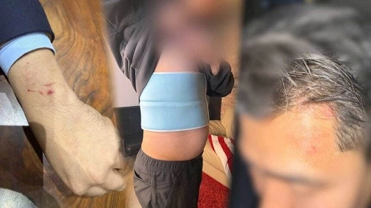 런닝화 호카 본사. 폭행 관련 총판과 계약 해지.