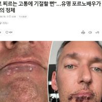 ""칼로 찌르는 고통에 기절할 뻔""…유명 포르노배우가 걸린 이병의 정체