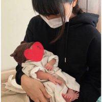 백신 부작용으로 탈모가 왔다던 일본녀 근황